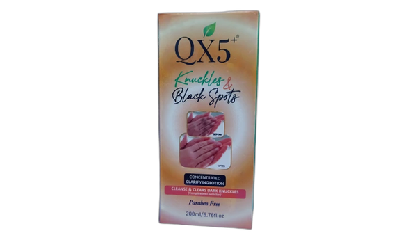 Qx5+ knuckles and black spot